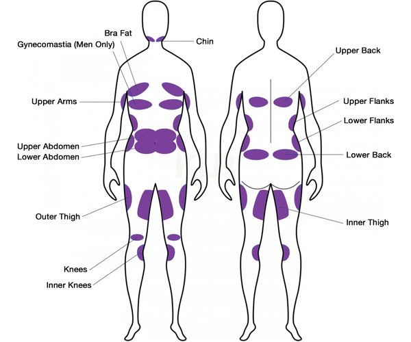 Non-Invasive Body Contouring - TruSculpt 3d - Columbia Skin Clinic